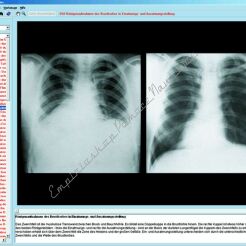 Układ oddechowy i układ krążenia człowieka. Ludzkie serce - CD-ROM ze zdjęciami preparatów mikroskopowych