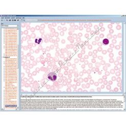 Biologia A - CD-ROM ze zdjęciami preparatów mikroskopowych