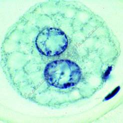 Embriologia nicieni - zestaw 10 preparatów GWARANCJA NAJNIŻSZEJ CENY