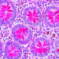 Histologia człowieka - kompletny zestaw 100 preparatów GWARANCJA NAJNIŻSZEJ CENY