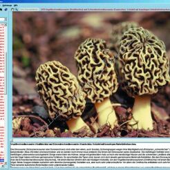Grzyby jadalne i trujące - CD-ROM ze zdjęciami preparatów mikroskopowych