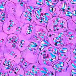 Komórka roślinna - zestaw 12 preparatów GWARANCJA NAJNIŻSZEJ CENY