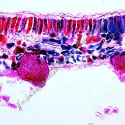 Rolnictwo i leśnictwo, cz. I - grzyby pasożytnicze (20 preparatów) GWARANCJA NAJNIŻSZEJ CENY