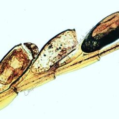 Owady: Archiptera, Rhynchota - zestaw 10 preparatów GWARANCJA NAJNIŻSZEJ CENY