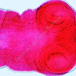 Robaki - zestaw 20 preparatów GWARANCJA NAJNIŻSZEJ CENY