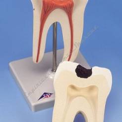 Ząb - dolny trzonowy, model dwukorzeniowy, 2-częściowy D10/4