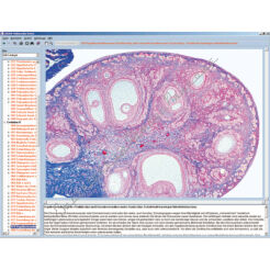 Biologia C - CD-ROM ze zdjęciami preparatów mikroskopowych